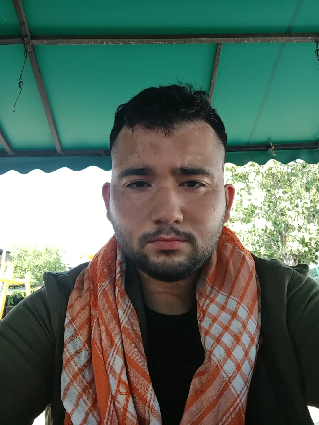 Türkiye'de Turanid Fenotipinin Daha Sık Görüldüğü Yerler
